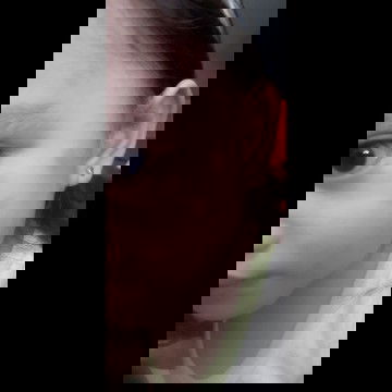 Pantal pantal na pula sa mukha