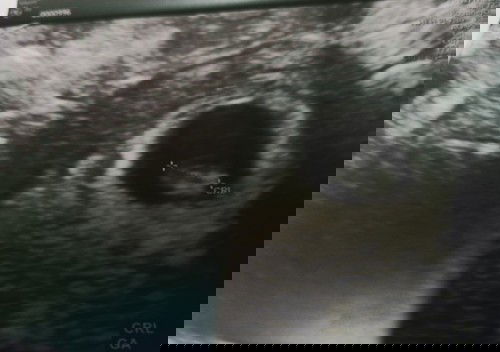 ตัวเล็ก อายุ 7 สัปดาห์ แล้วครับ 🤍🤙