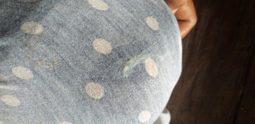 ในรุปคือมูกหรือตกขาว