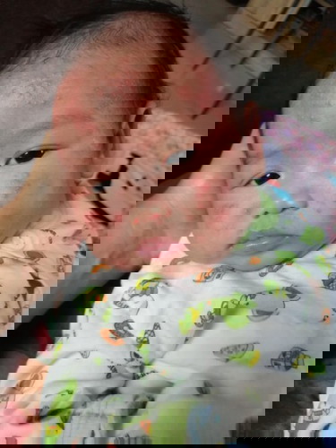 ผื่นแดงลูกใครเป็นบ้าง