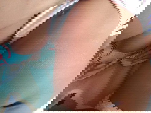 สอบถามค่ะ ลูกมีผิวลอกๆแบบนี้ขึ้นที่หน้าท้อง อยากทราบว่าบ้านไหนเคยเป็นแบบนี้บ้างคะ