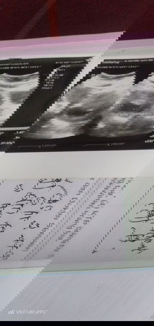 Assalamu'alaikum bunda2..bolehkah saya bertanya di sini.kandungan saya kira2 msih muda