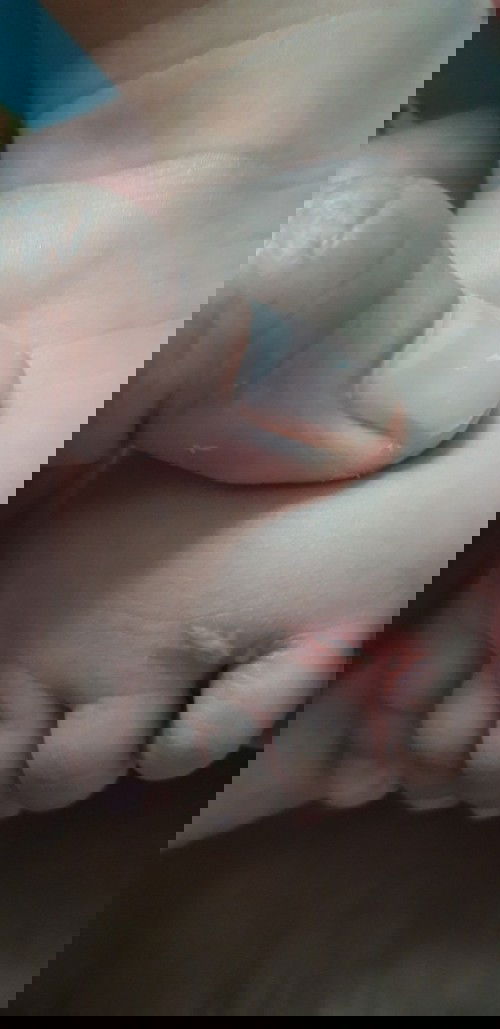 Jari kelingking kaki