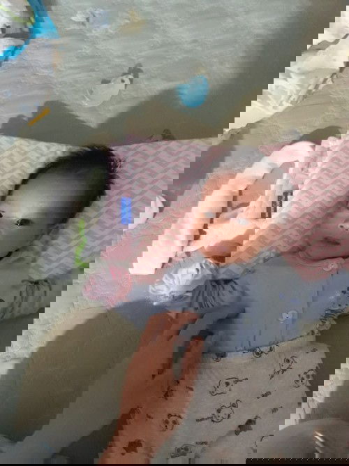 Bẹp đầu một bên