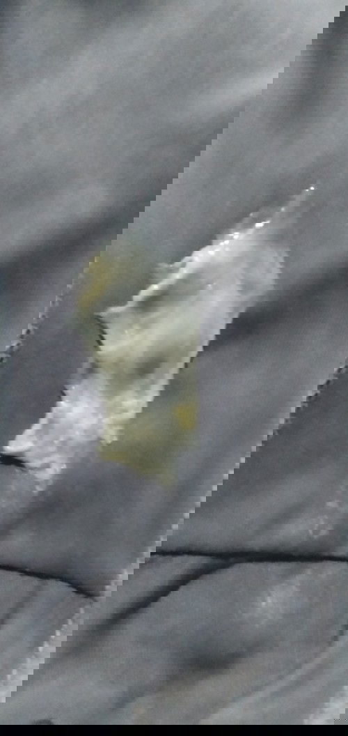 ใกล้คลอดหรือเปล่า