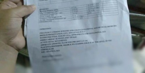 Ask lang po. Sana may sumagot ☹️