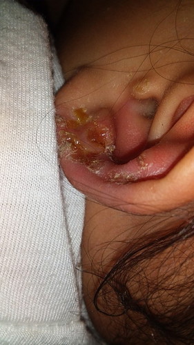 Skin Problem