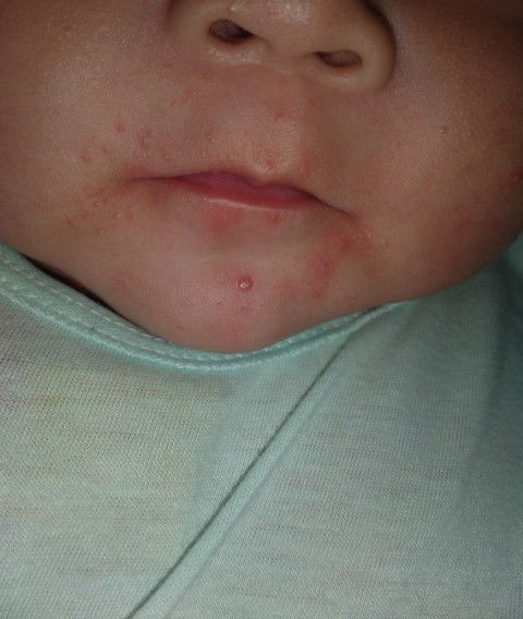 Mom nào thông thái chỉ giúp e với ạ