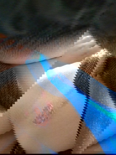 Skin problems