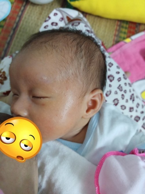 Cách ti mẹ