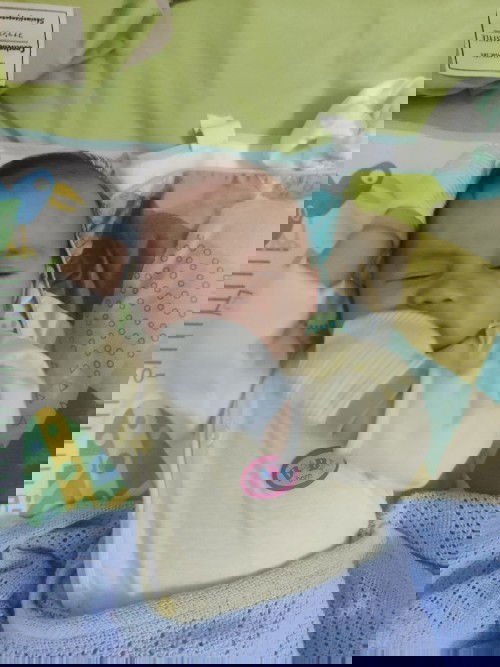 Bé 2 - 3 tháng hay tự vò đầu tai