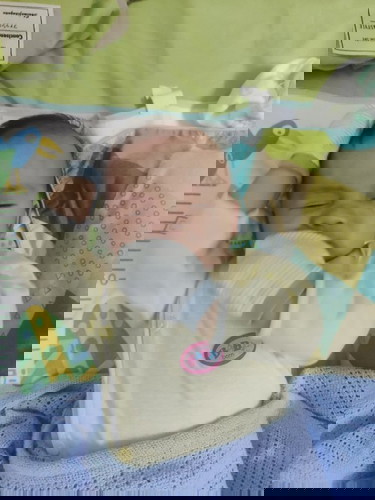 Bé 2 - 3 tháng hay tự vò đầu tai