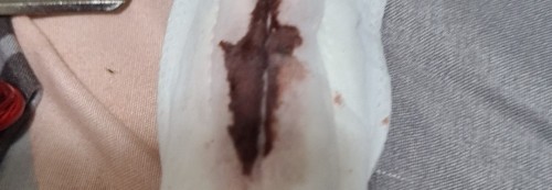 Brown spotting. No blood smell.