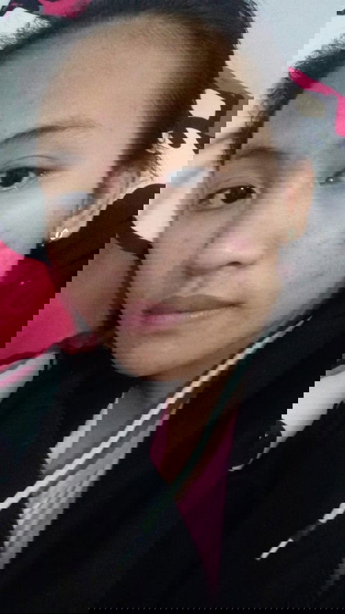 Hamil banyak jerawat