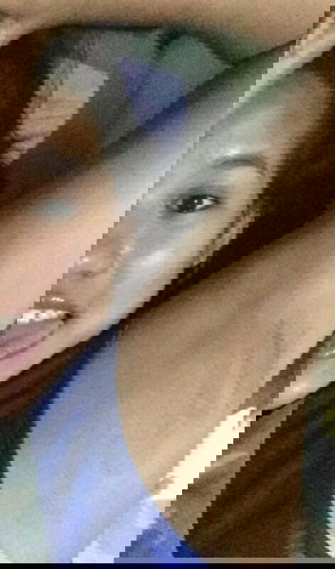 Postpartum Dark skin