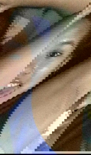 Postpartum Dark skin