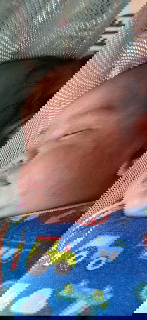 Anak sya umur 2 buln lebih,kenapa yah saya KSI sufor badannya langsung merah dan benjol?apa sih obat