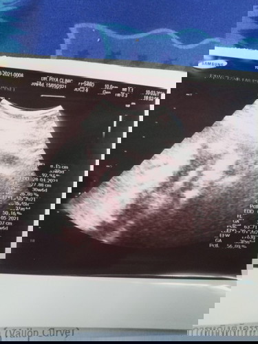 อายุครรภ์30+นองหนักเท่าใรกันเเล้วคะ