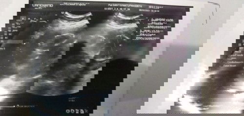 Ari..ari nya di bawah