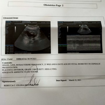 Baby girl na ba talaga? 🥰🤰