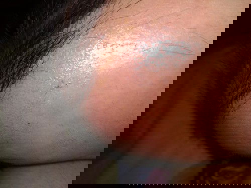 Kepala Baby Lecet Merah Berair