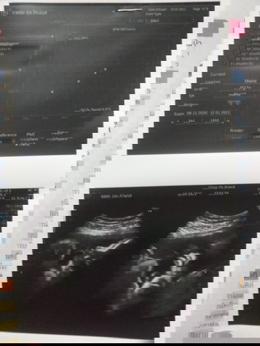 ความทรงจำ 👶