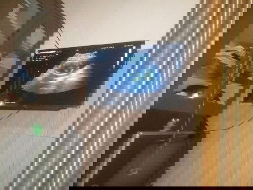 Video usg di 23 week