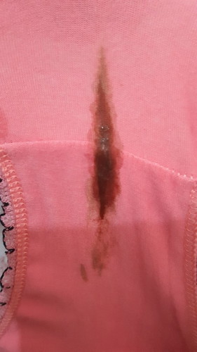 Spotting / reddish discharge