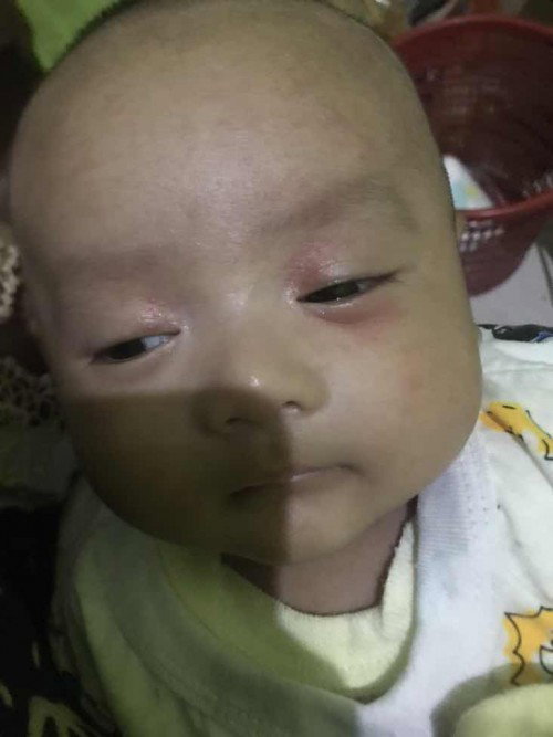Kasihan Bunddd