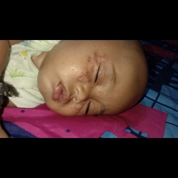 gatel