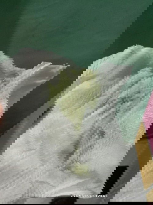 Keputihan usia kehamilan 37 minggu