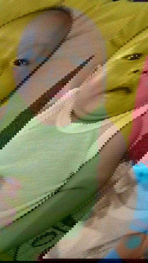 kemerahan di lipatan dan putih2 seperti panu pada bayi