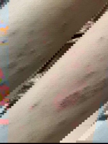 Skin issue