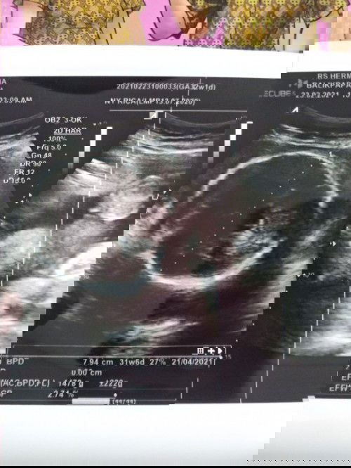 36w, Cerita Kehamilan, Jadi Sering Mellow