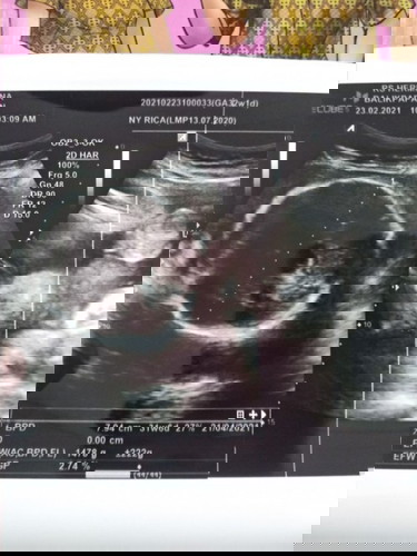 36w, Cerita Kehamilan, Jadi Sering Mellow