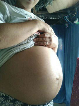 31st week bump