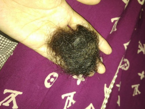 Rambut rontok