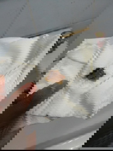 อยากถามเเม่ๆหน่อยค่ะ มีเเบบนี้ออกมาต้องทำยังไงคะ? ต้องไปหาหมอหรือป่าว