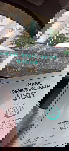 Bun kalau bayi lahir udah boleh langsung dipakeim diapers belum kayak sweety Gold Comfort/ Mamypoko?