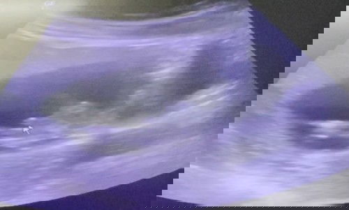 หญิงหรือชายคะ แม่ๆช่วยดูให้หน่อยค่ะ ดูไม่เป็น😊😊😊