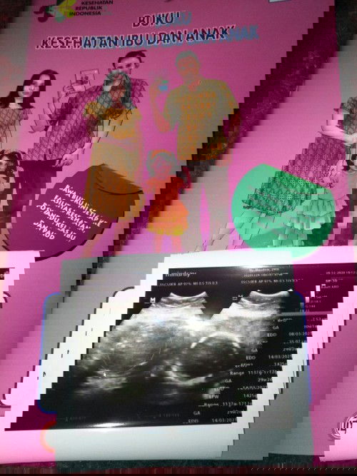 Minta doa dan dukungan nya 🙏😍