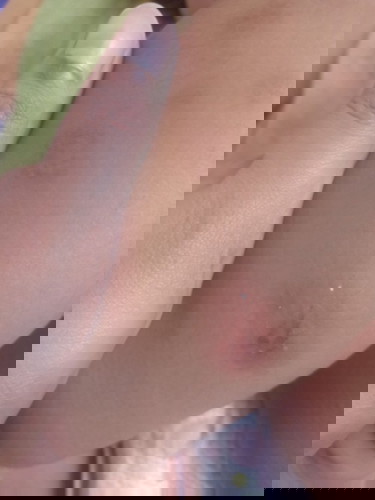 Hi mommies, ask po sana kung ano po ito na dumadaming pantal sa binti ni baby, 1 year 4 months, tia