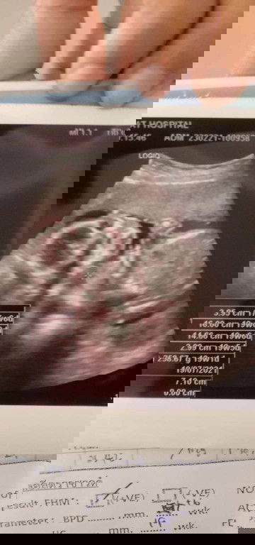 หญิง หรือ ชาย