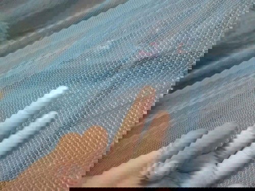 เเม่ๆจ้าเเบบนี้คือปกติไหมค่ะ เราพึ่งตื่นพอเราไปจับ มันก็เป็นสีขาวขุ่นๆ ตอนนี้ 28+6 เเล้ว