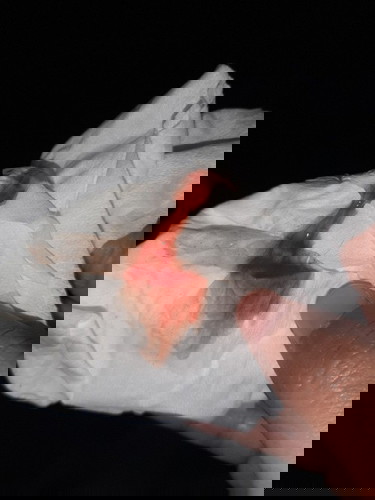 ท้อง 40+3 ใช่มูกเลือดไหมคะ