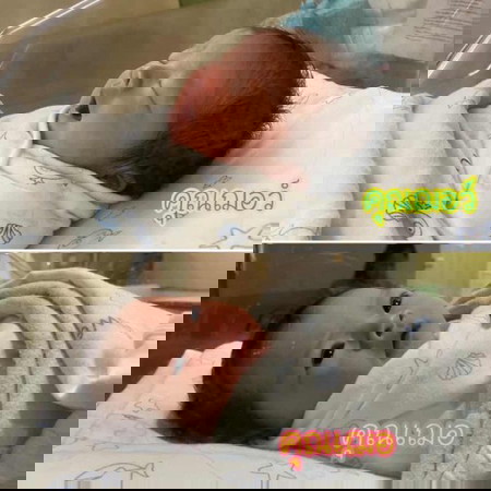 แชร์ประสบการณ์ผ่าคลอด รกเกาะต่ำ + ทำหมัน ท้อง 2