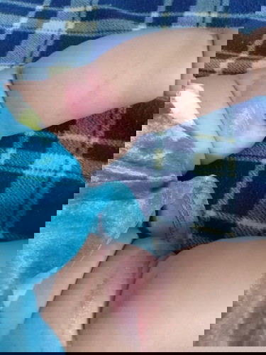 Ano po pwdeng igamot dito?