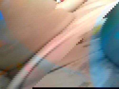 รอยฉีดวัคซีน