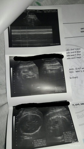 ultrasound