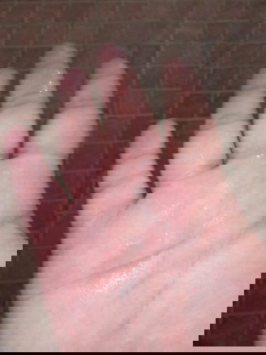 มูกหรือตกขาว